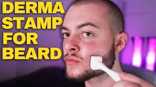 How To Derma Stamp Beard Properly (Derma Stamp Tutorial, Minoxidil & Derma Stamp)