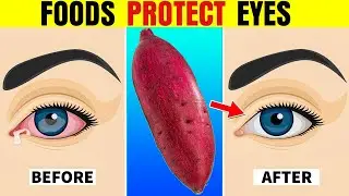 8 Foods That Protect Eyes and Repair Vision