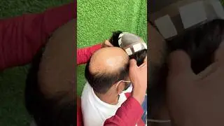 Best Wig Shop In Delhi | 9990115900 | Hair Wig Training In Delhi Price #hairwig #delhi #hairpatch