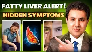 Do You Have Fatty Liver? 7 Hidden Symptoms Most People Miss