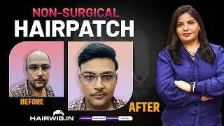 Men Hair Patch #style #transformation #PinkiSingh #lucknow #trending #viral #hairwig #hairwig