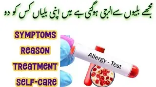 Cats s allergy Kyo Hoti h || Allergy Testing Urdu Hindi - Allergy Ke Liye Kaun Sa Test Hota Hai