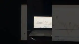 Trading Setup Unveiled! 📈💻 #traderlife #tradingsetup  #harshadmehta #financialfreedom #stock 🎉📊