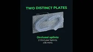 🦷 Elevate Your Dental Practice with Lumii DLP 3D Printer!