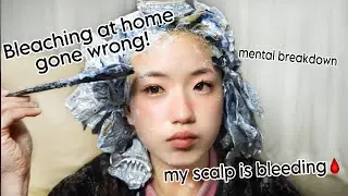 BLEACHING MY HAIR AT HOME WENT HORRIBLY WRONG!(bleach burn,blood, scabs and healing)