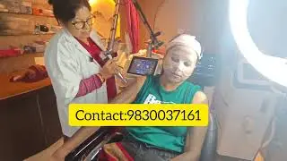 Pigmentation+acne treatment #skincare #beauty #eyebrows #laserhairremoval #hair
