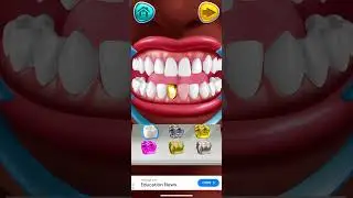 Sone ke teeth #doctor #gobestdentistfacts #humanteeth #dentist #funny #teeth #comedy #teeths #facts