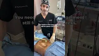 Perks of doing an awake procedure like Bodytite?     You get live entertainment from Dr. Tag 🤣