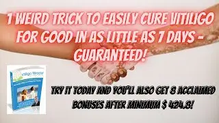 Heal Vitiligo and Restore Skin Pigmentation And Natural Color Of Your Skin In the next 7 Days!