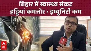 Patna के विशेषज्ञ हड्डी रोग Dr. Ashwini Gaurav का बयान: धूप न मिलने से 80% बिहारवासियों को खतरा !