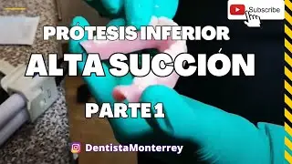 🤔 Cómo Lograr👅ALTA SUCCIÓN en Prótesis INFERIOR parte1🔥