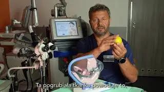 PCOS w leczeniu niepłodności w Klinice Galena