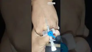 How to Insert Blue Cannula (22G) Step by Step | Nursing Skills | IV Cannula Insertion #shorts