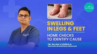 Why Your Legs Are Swollen | Leg Swelling vs Fat | Simple Home Tests to Identify the Cause #10seconds