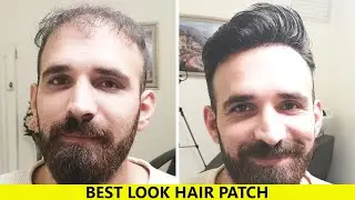 Hair Wig | Patch in Patna | Wig for Men in Patna #hairpatch #hairwig