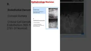 #mbbs OPTHALMOLOGY (SPECULAR MICROSCOPY for Cornea) NEETPG