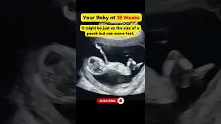 13 Weeks Baby Moves A Lot in the Womb 😍