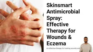 Skinsmart Antimicrobial Spray: Effective Therapy for Wounds & Eczema