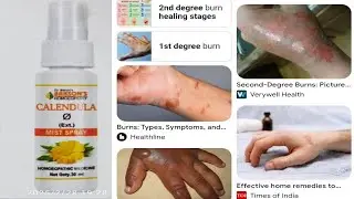 CALENDULA MIST SPRAY / CALENDULA SPRAY USES हिन्दी में पूरी जानकारी