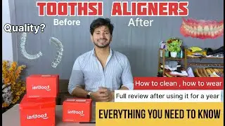 Toothsi Aligners Review And Unboxing (1 year experience) | Everthing you need to know #1