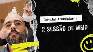 3 meses de transplante capilar- tirando d&uacute;vidas, 2 sess&atilde;o de MMP