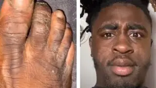 Hood Meals TikTok Compilation