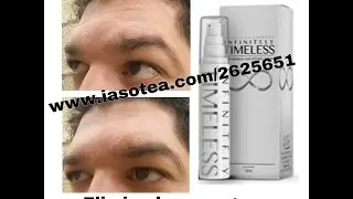 Iaso TIMELESS El RETO TLC