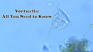 Uncovering Vorticella: The Fascinating World of Microscopic Organisms