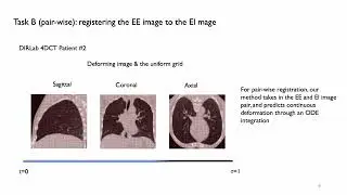 ORRN: An ODE-based  Network for Deformable Respiratory Motion Estimation With Lung 4DCT Images
