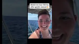 Watch me lose 130 lbs after gastric sleeve! ✨