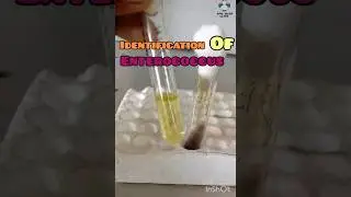 Identify Enterococcus Fecalis | Bile Esculin Agar | Catalase Test | GPC #bacteriology #microbiology