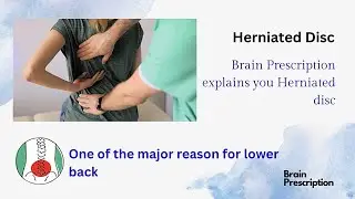 Herniated disc- A common cause of back pain across all age group