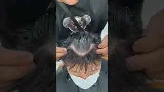 Don&rsquo;t give up your hairline 😲😲 | Frontal Hairpiece For Men | Hi Toupee Hair Replacement