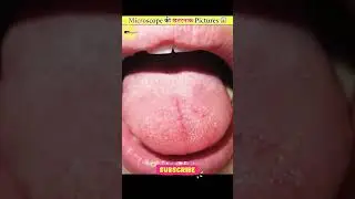 Microscope की खतरनाक picture 😱#facts #viralvideo #viral #video #viralshorts #new #suscribe