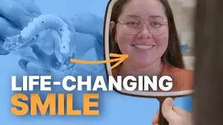 Permanent Teeth | A Life Changing Smile Solution