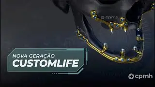 CustomLife - Nova Gera&ccedil;&atilde;o