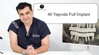 Çene Cerrahı Anlatıyor - 40 Yaşında Full İmplant