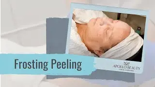 Frosting Peeling | Rotterdam