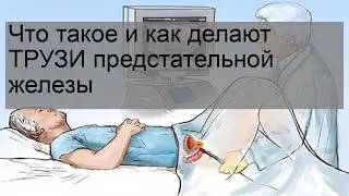 Что такое и как делают ТРУЗИ предстательной железы