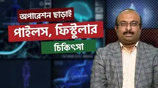 অপারেশন না করে কি পাইলস, ফিস্টুলার চিকিৎসা সম্ভব? | Dr. Chowdhury Sajjad Haider | Sastho Barta