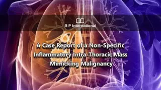 A Case Report of a Non-Specific Inflammatory Intra-Thoracic Mass Mimicking Malignancy