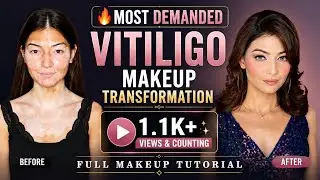 Flawless Makeup for Vitiligo & textured skin 
