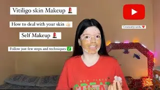 Vitiligo skin Makeup tutorial 💄|| Creationbyvarsha ❤️|| #like  #tutorial   #vitiligo