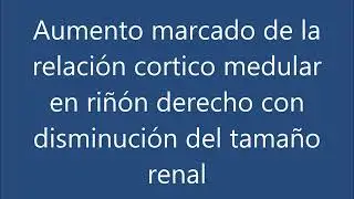 Ri&ntilde;&oacute;n con gran c&aacute;lculo y el ri&ntilde;&oacute;n contrario con alteraciones paranquemitosas generalizadas