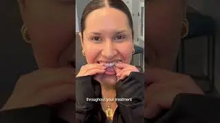 Почему некоторые люди выбирают Invisalign вместо брекетов 🦷