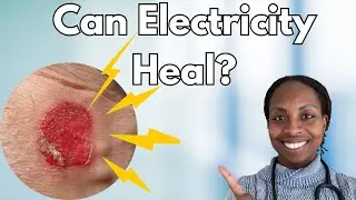 Electric Therapy: Healing Wounds with Shocks? Doctor Explains