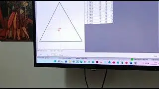 Riabilitazione vestibolare in stabilometria