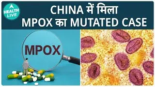 Monkeypox क्या है? जानिए इसके लक्षण और सुरक्षा उपाय! | Mpox | Health Live