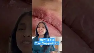 Why Chapstick Isn&rsquo;t Fixing Your Lips