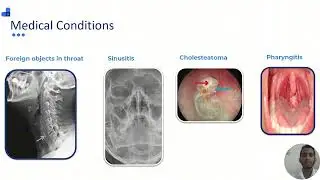 Automated Medical Conditions Detection in E.N.T Images Using Deep Learning Techniques